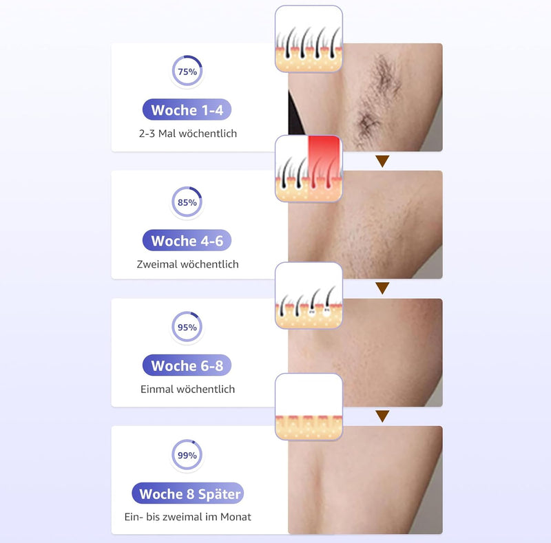 Rodzon IPL Geräte Haarentfernung Laser für Männer und Frauen, 999,999 Lichtimpulse Laser Haarentfern