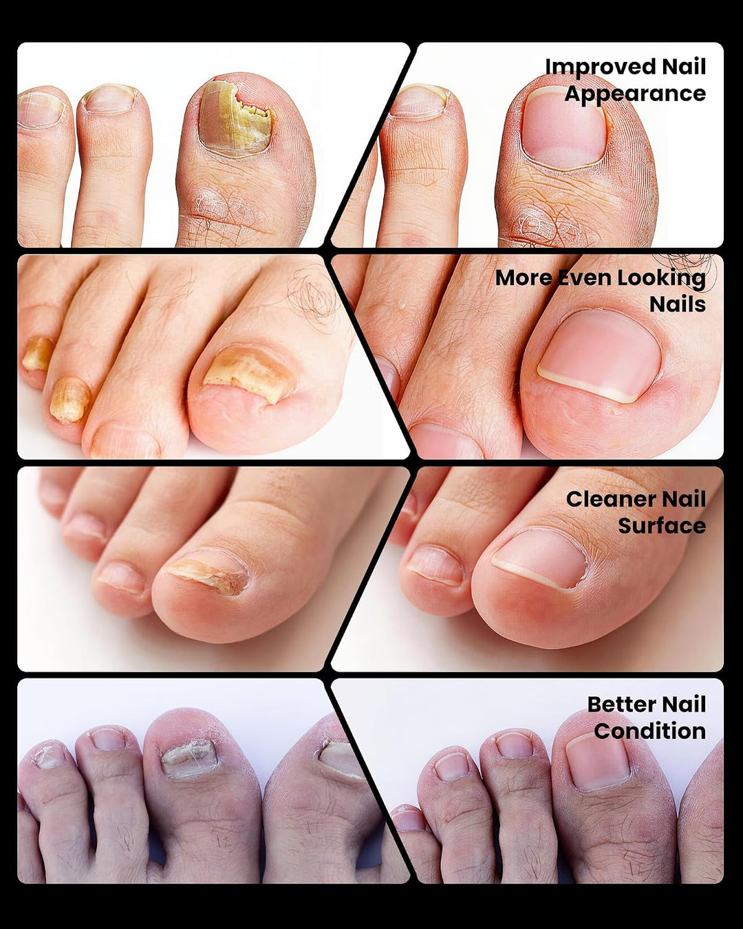 Wiederaufladbare Nagelpflege Lichtgerät - Blaues &amp; Infrarotlicht für Nagelhygiene &amp; Aussehpflege - T