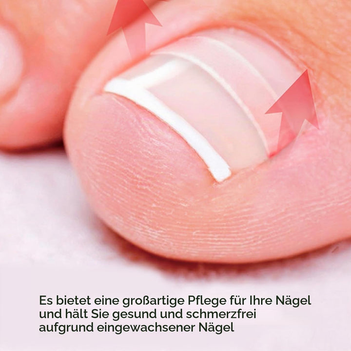 Supvox Zehennagel Korrektur Aufkleber Eingewachsener Zehennagel Fussnagel Korrektur Fusspflege Pedik