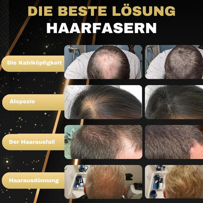 SALVATHOR DURAN Streuhaar zur Haarverdichtung - Schütthaar zur vollem Haar in Sekunden - Haar Puder