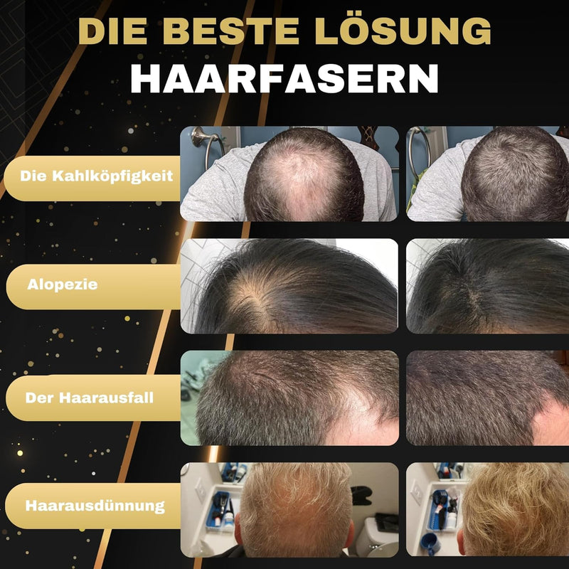 SALVATHOR DURAN Streuhaar zur Haarverdichtung - Schütthaar zur vollem Haar in Sekunden - Haar Puder