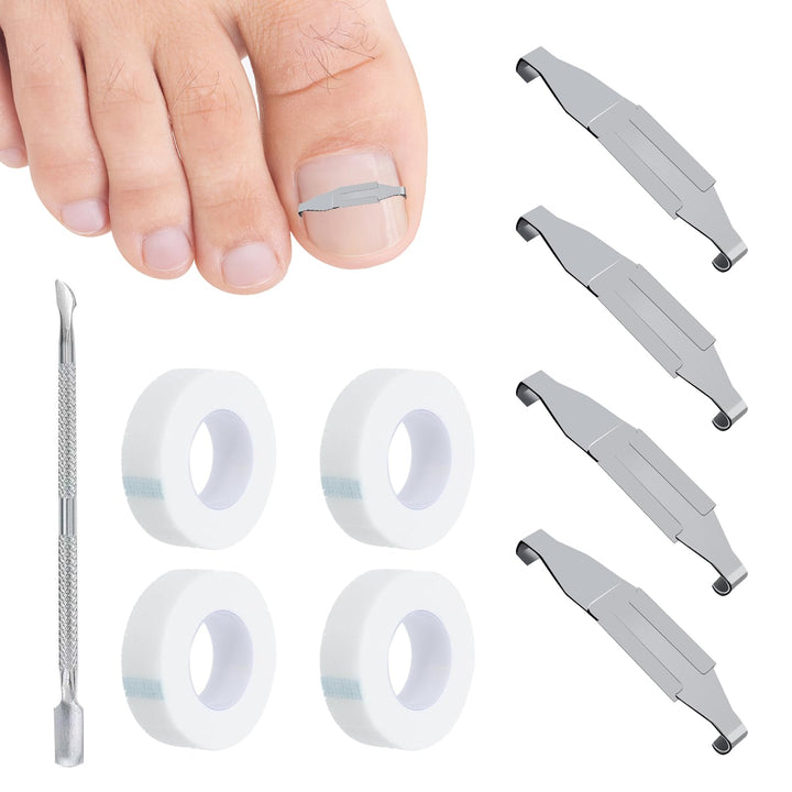 4 Stück Eingewachsene Zehennägel Set Fussnagel Eingewachsen Spange Nagelspangen Für Fussnägel Zehenn