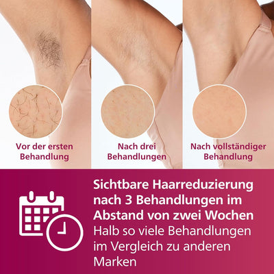 Philips Lumea IPL Advanced, 2 Aufsätze – Haarentfernungsgerät mit Satin Compact Korrekturtrimmer