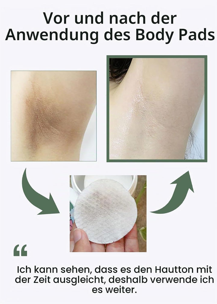 celimax One Step Body Brightening Pad Peeling-Pad Für Körper, Achselhöhlen, Knie & Ellbogen, Mit Grü