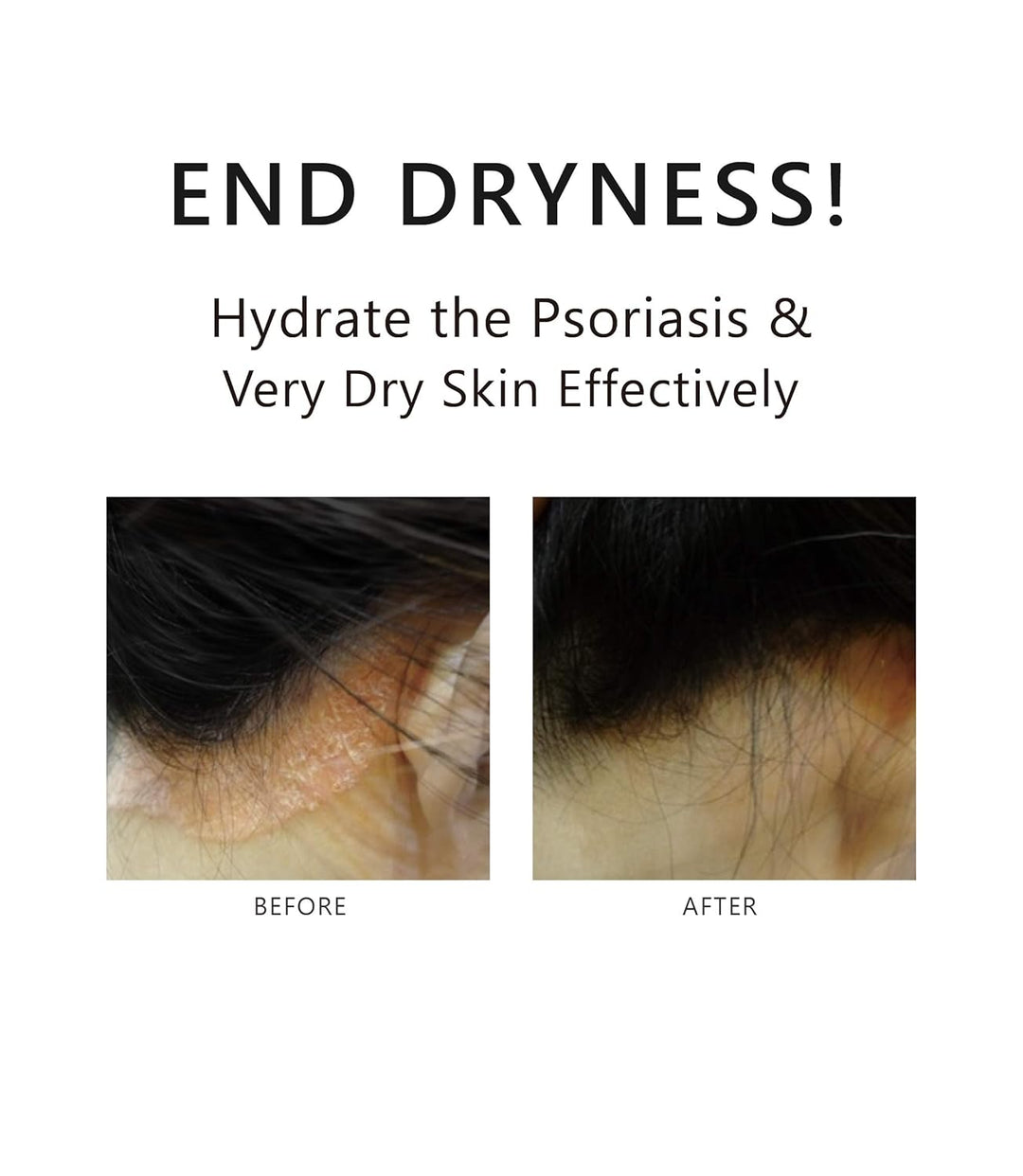 AROMASE Glycyrrhetinic Acid Skin Care Tonic