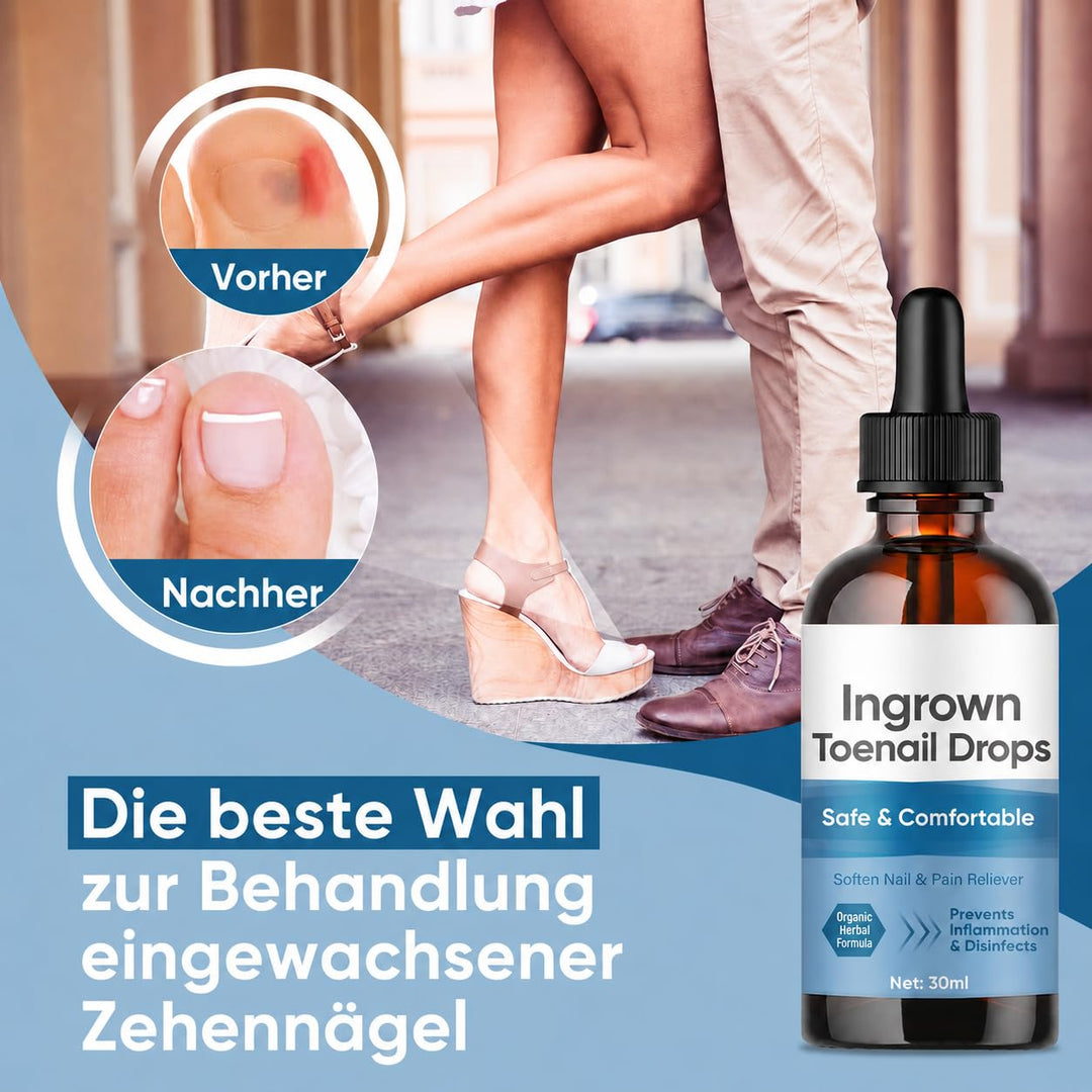 Eingewachsene ZehennäGel Tropfen, Korrekturtropfen | FüR Eingewachsene ZehennäGel, Schnell Wirkende