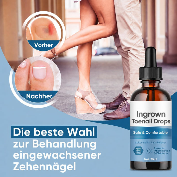 Eingewachsene ZehennäGel Tropfen, Korrekturtropfen | FüR Eingewachsene ZehennäGel, Schnell Wirkende