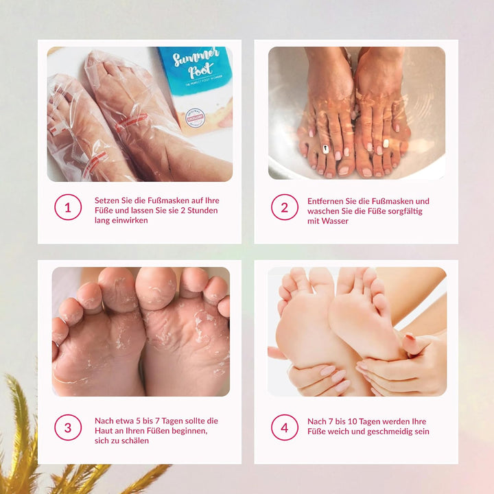 Summer Foot Premium Hornhaut-Entferner - Hornhaut Fussmaske für weiche Füsse - Anti Hornhaut-Socken