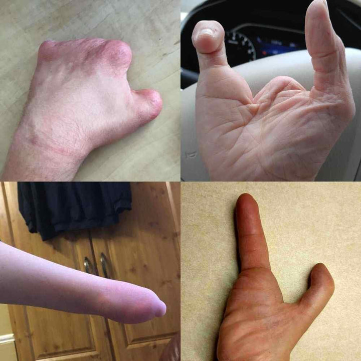 active hands Griffhilfe für Gliedmassen S Right, S Right
