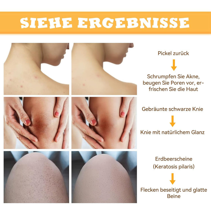 ANAiRUi Körperpeeling Body Scrub Kurkuma, Peeling für Körper-Gesicht Hyperpigmentierung Dunkle Fleck