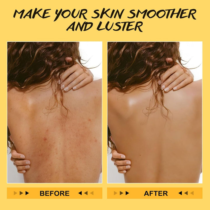 Körperpeeling mit Kurkuma Vitamin C, Peeling, entfernt abgestorbene Haut, verbessert dunkle Flecken,