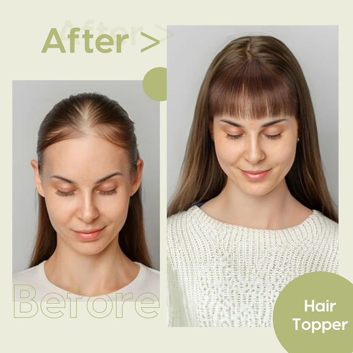 S-noilite Echthaar Hair Topper für Frauen mit Pony Haarteile für Dünnes Haar Echtes Menschliches Haa