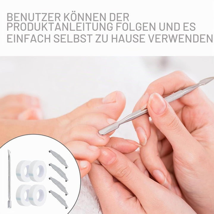 4 Stück Eingewachsene Zehennägel Set Fussnagel Eingewachsen Spange Nagelspangen Für Fussnägel Zehenn