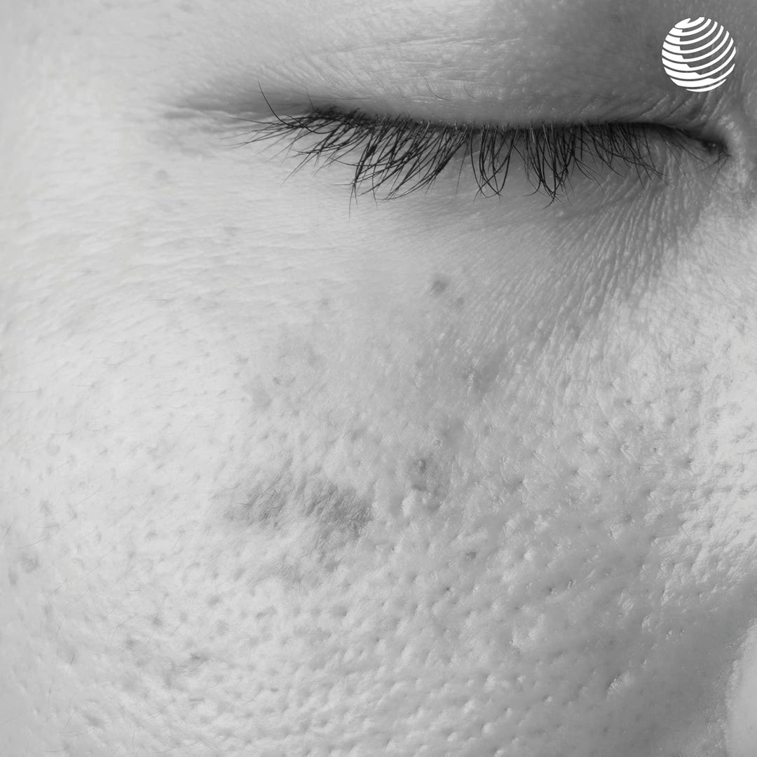 Dr. Rimpler Gesichtscreme mit Lichtschutzfaktor "Brightening Cream" I Gesichtspflege bei Pigmentflec