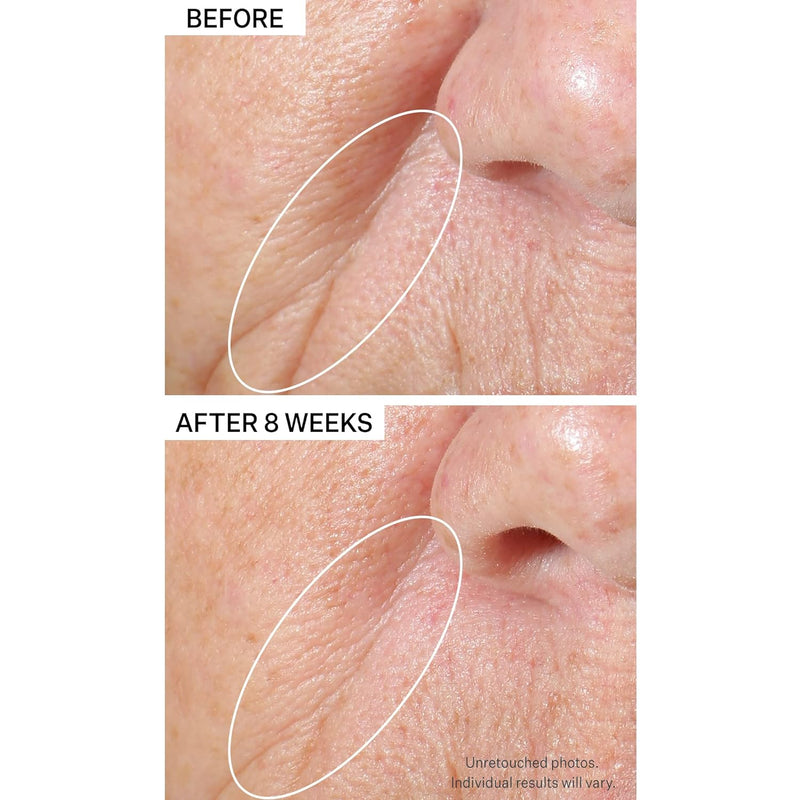StriVectinTIGHTENING face serum 50 ml
