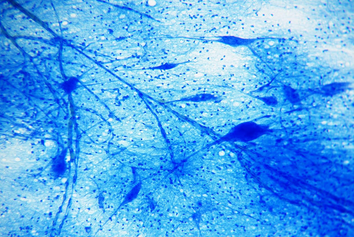 Bresser Mikroskop Dauerpräparate 25 Stück in Kunststoffbox, Lernpräparate aus der Biologie 25 Stück
