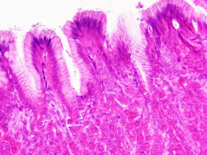 Bresser Mikroskop Dauerpräparate 30 Stück in Kunststoffbox, Lernpräparate aus der Biologie Single, S