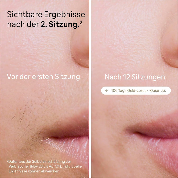 Braun IPL Silk Expert Pro 5 Haarentfernungsgerät Damen/Herren, 2 Aufsätze, sichtbare Haarentfernung,