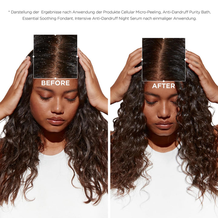 Kérastase Symbiose, Entwirrender Anti-Schuppen Conditioner, Spülung für empfindliche Kopfhaut, Ohne