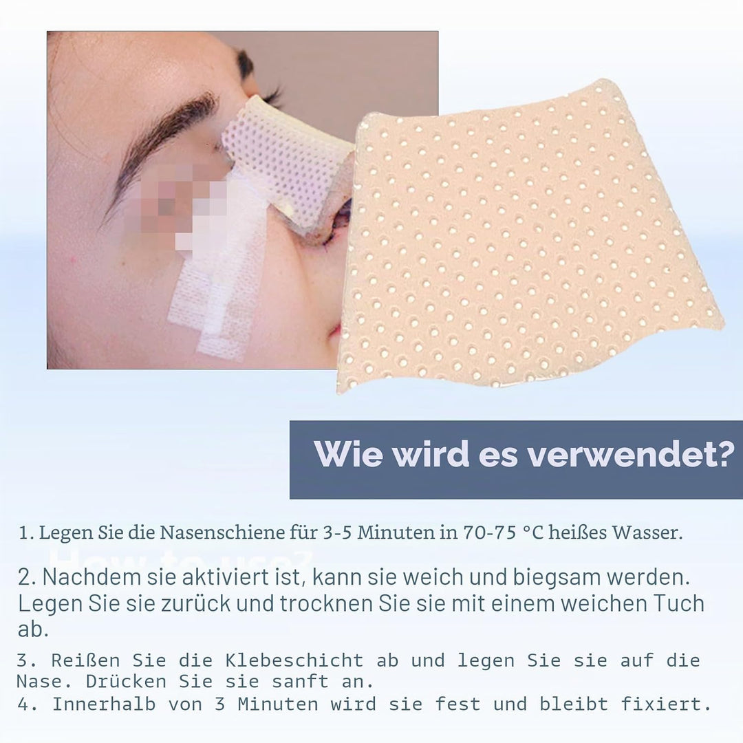 Thermoplastische Nasenschienen, externe Nasenstützung, Schutz für Nasenbandage, Rhinoplastie, Septop