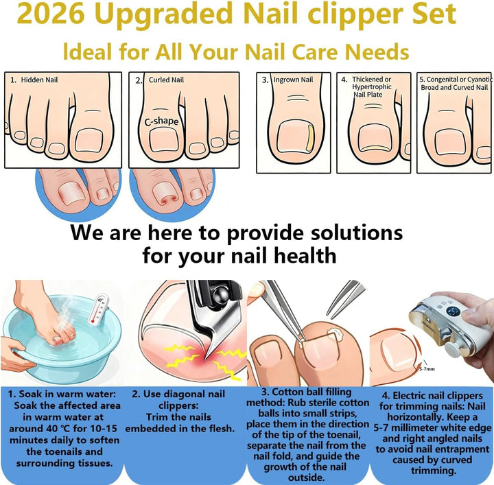 Elektrischer Nagelknipser + Schrägknipser Set – 3-in-1 Nagelfeile mit LED, Alloy-Klinge, leise & vib