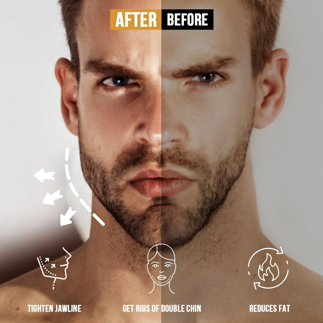 HUGEOAKS Kiefertrainer, Einstellbarer Widerstand, 46-130 LBS, Kiefer-, Gesichts- und Nackentrainer,