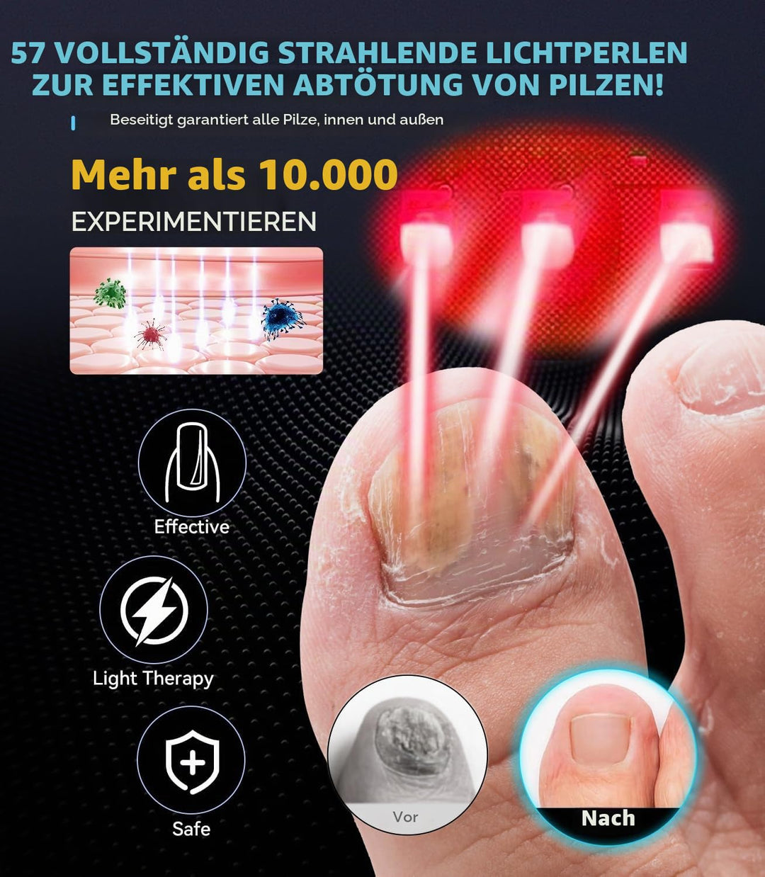 2025 Upgrade Nagelpil Lasergerä【Verwendung für Mehrere Fingernägel und Zehennägel - 3/5/7/10min】Nage