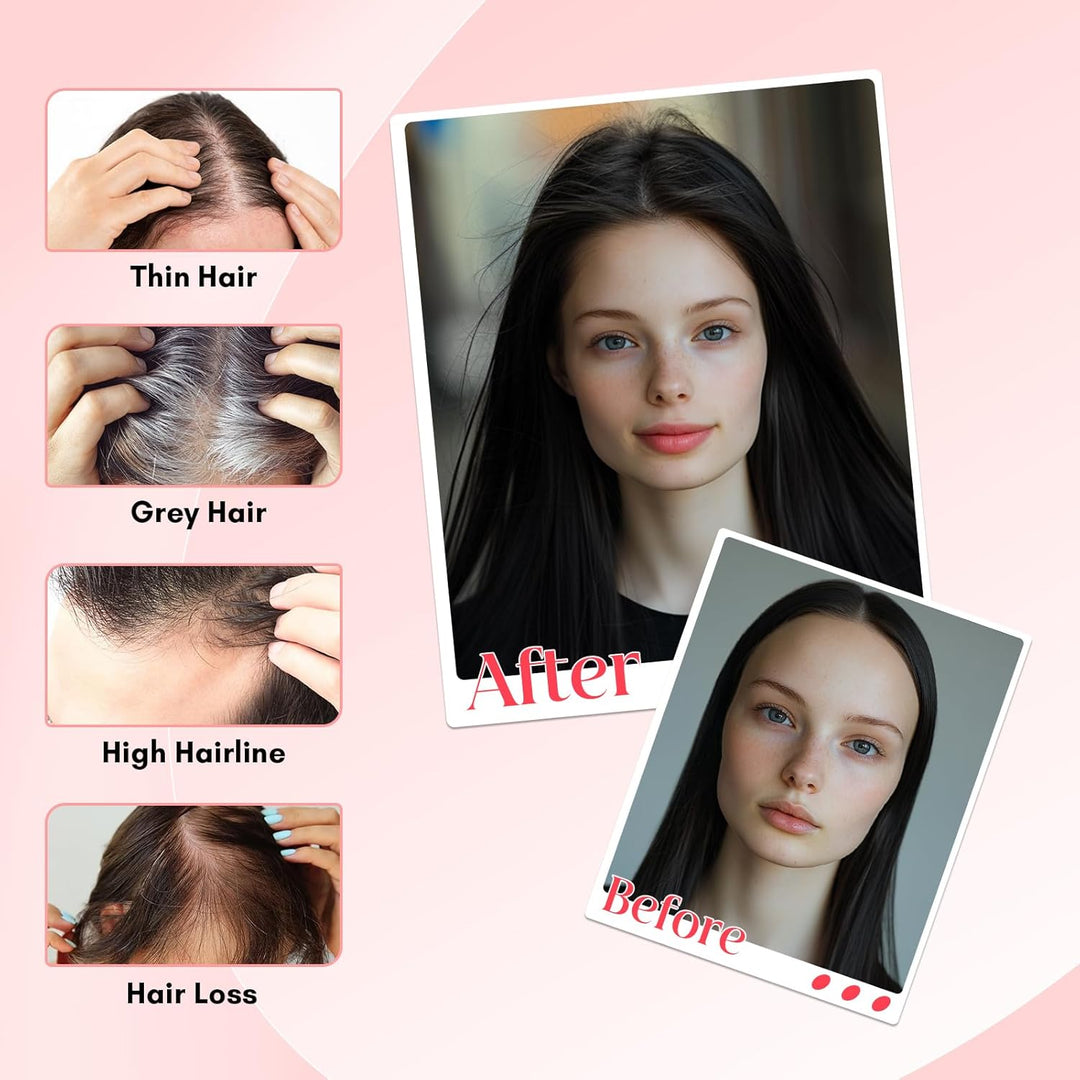 Elailite Hair Topper Echthaar #1B Naturschwarz 20cm Clip in Toupet Damen Extensions Haarteil Haartop