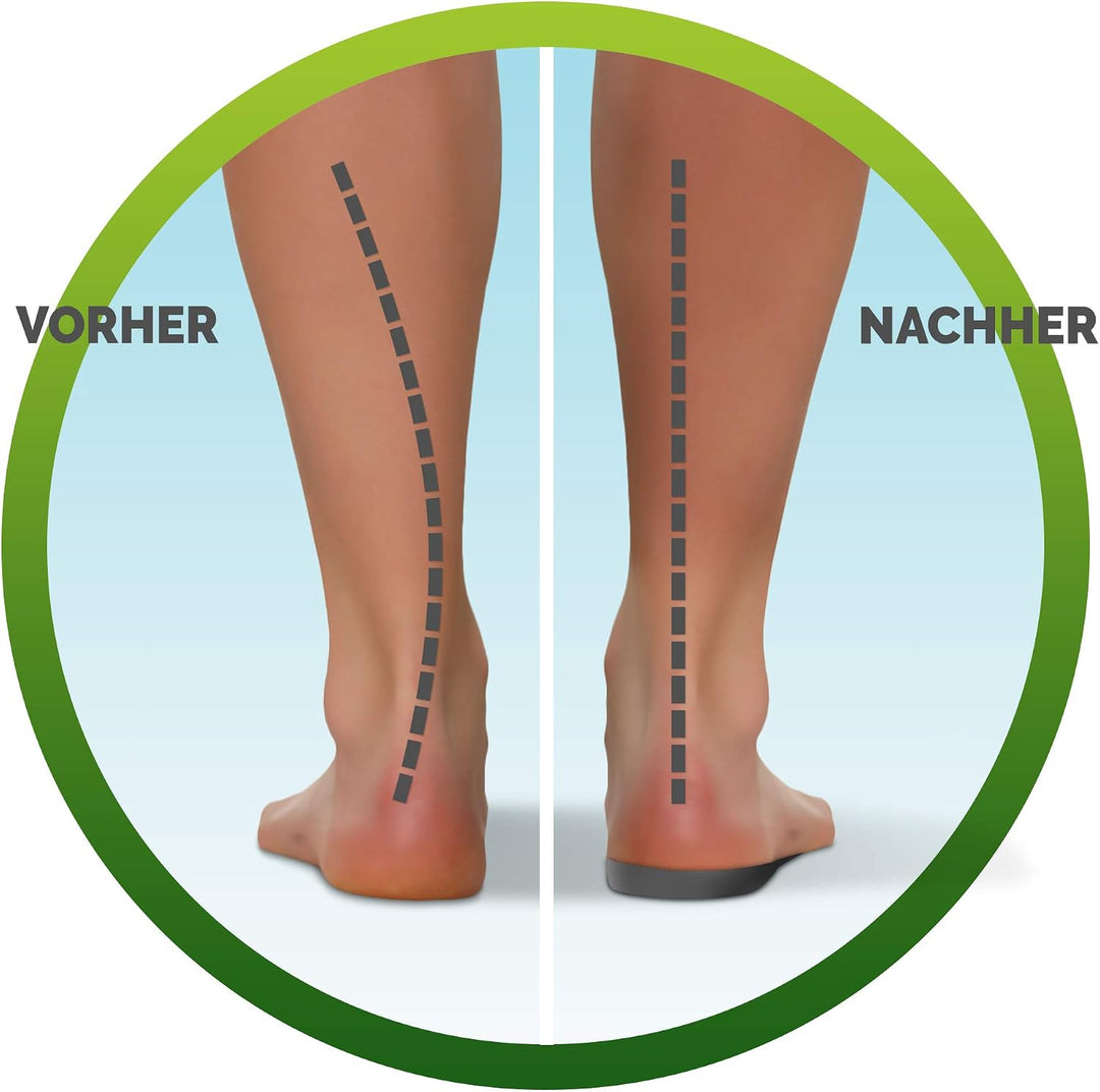 Scholl InBalance Einlegesohlen für Schuhe in Grösse 42.5-45 – Sohlen bei Schmerzen im Fussgewölbe –