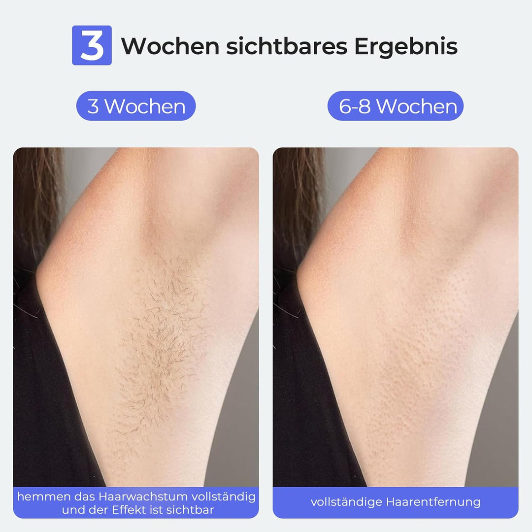 Haarentfernung Laser mit Saphir-Eis-Kühlung Technologie, Schmerzfreie IPL Geräte Haarentfernung Dame