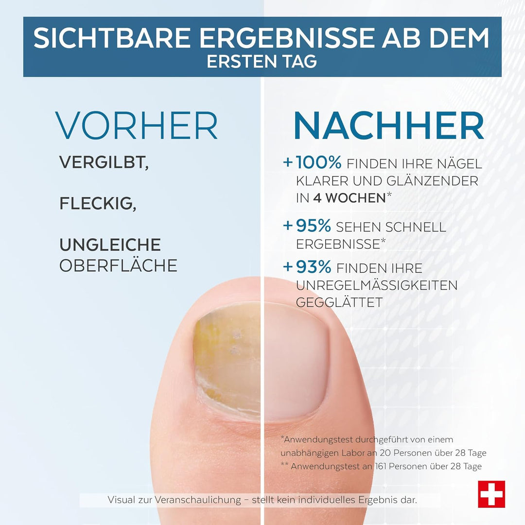 PODERM - Pflegeserum für verfärbte und beanspruchte Nägel - Verbessert das Erscheinungsbild der Näge