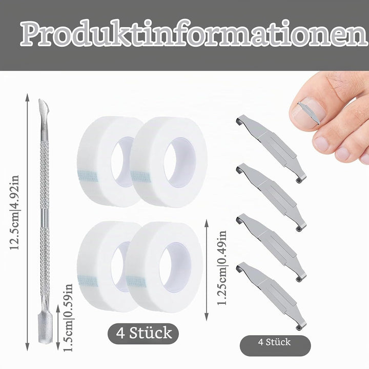4 Stück Eingewachsene Zehennägel Set Fussnagel Eingewachsen Spange Nagelspangen Für Fussnägel Zehenn