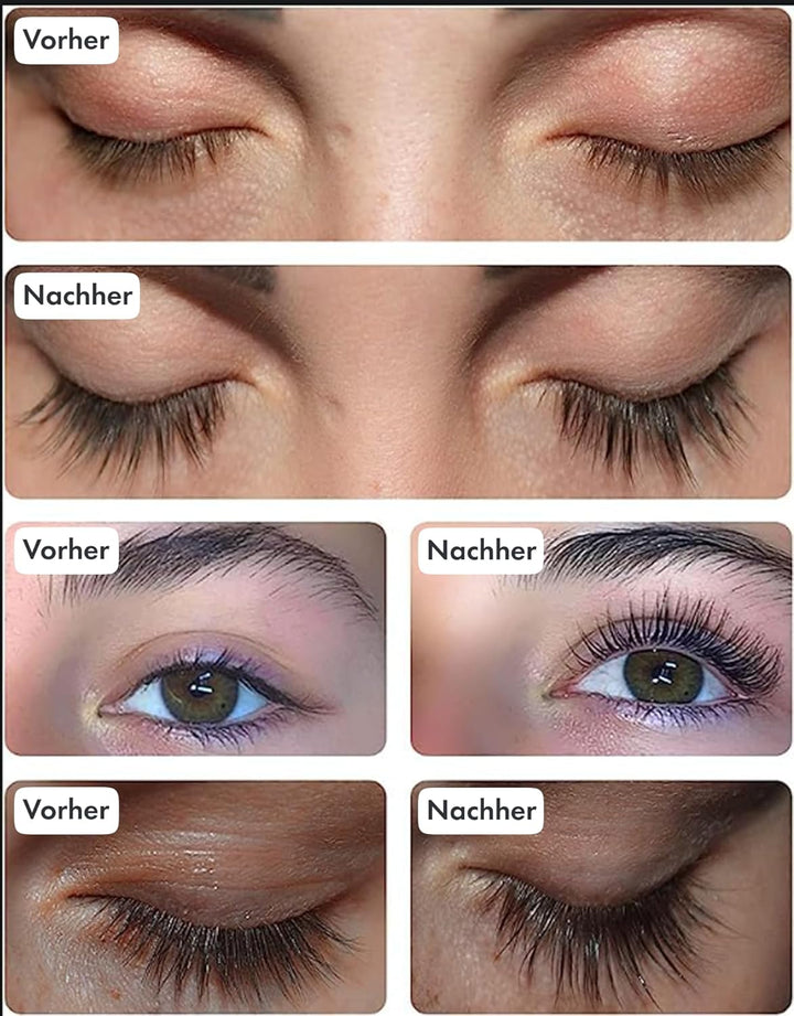 Toplash XL Wimpern- und Augenbrauen-Booster - Wachstumsserum mit Wimpern- und Augenbrauenverstärker