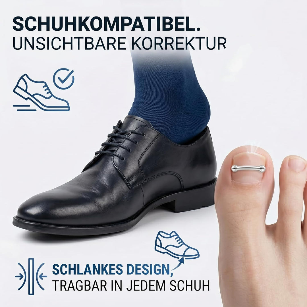 Eingewachsene Zehennägel Set, Zehennägel Korrektur Patch, Nagelspange Fussnägel, Entwickelt für Eing