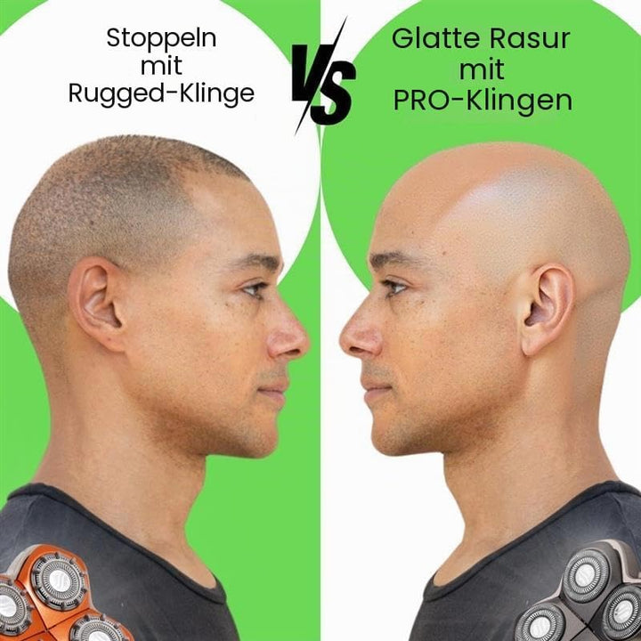 Skull Shaver Rugged 4 Head Ersatzklinge - Stoppel-Look, 10 Abstandshalter, 360° Konturierung, Hypoal