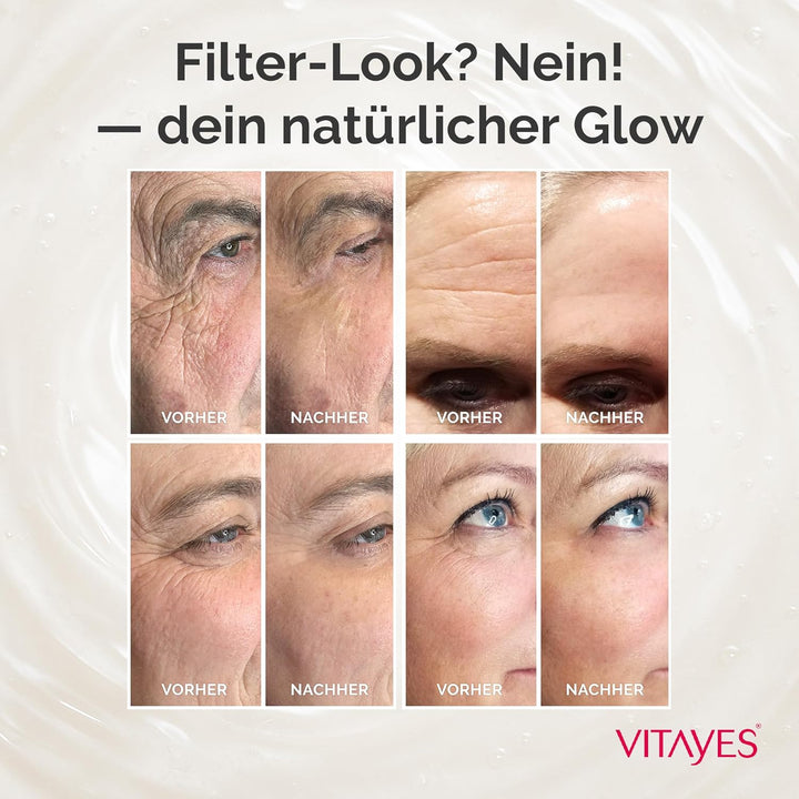 VITAYES Instant Ageback - Anti Aging Creme, Lifting Creme, Klinisch und dermatologisch getestet (15m