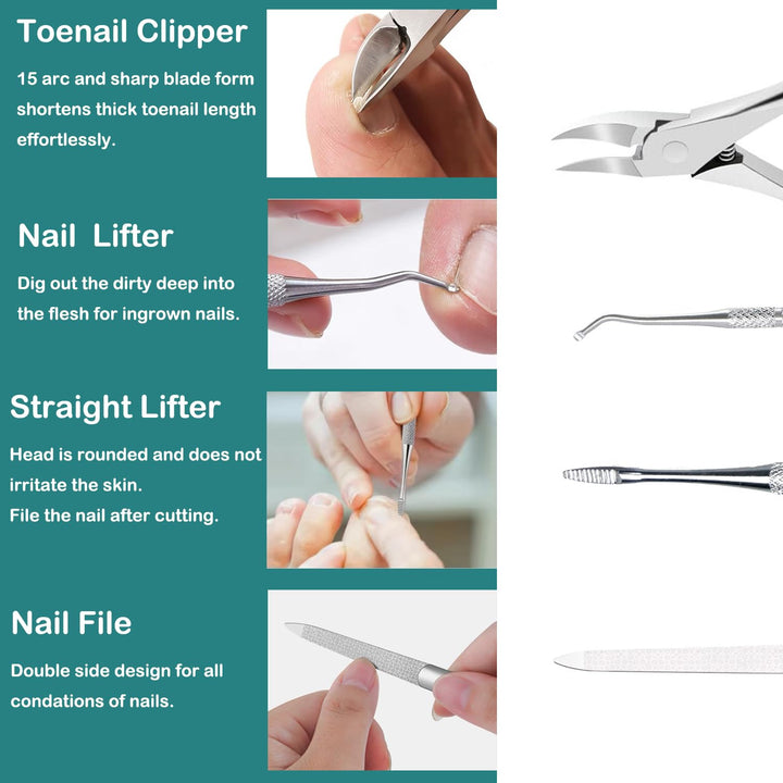 Ingrown Zehennagel Entfernung Kit, Pediküre Werkzeuge Kit Professionelles Messer Set Edelstahl Ingro
