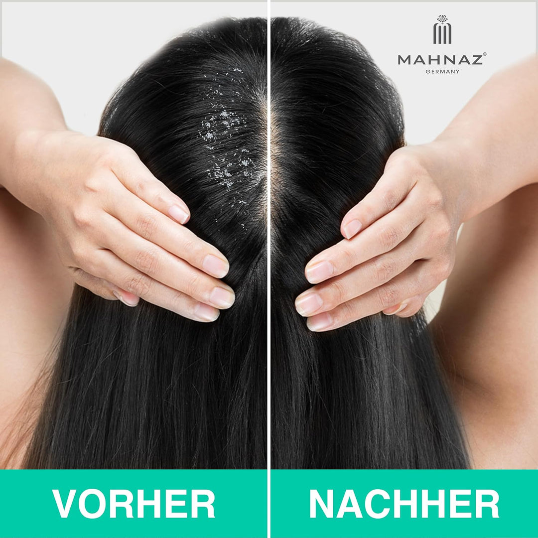 MAHNAZ® Bioaktives Kopfhautshampoo, gegen Schuppen, Juckreiz und fettige Kopfhaut, sanft &amp; wirksam,