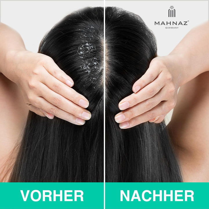 MAHNAZ® Bioaktives Kopfhautshampoo, gegen Schuppen, Juckreiz und fettige Kopfhaut, sanft &amp; wirksam,