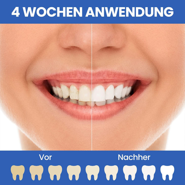 Oclean Flow Elektrische Zahnbürste, Schallzahnbürste mit 180 Tage Akkulaufzeit, 5 Putzmodi Zahnbürst