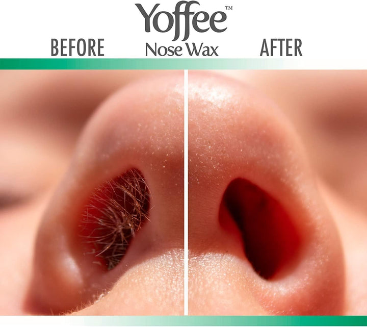 Original Yoffee Nose Wax Kit - Hair Removal Set - Männer und Frauen - Nasenhaarentferner - Bio Biene