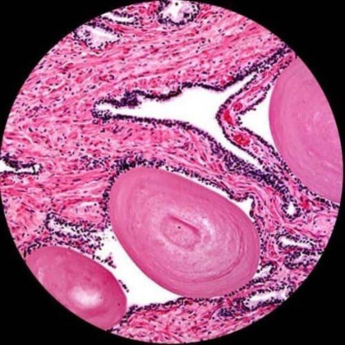 AmScope M150C-PS25 Zusammengesetztes Monokularmikroskop, Okulare WF10x und WF25x, 40x-1000x-Vergröss