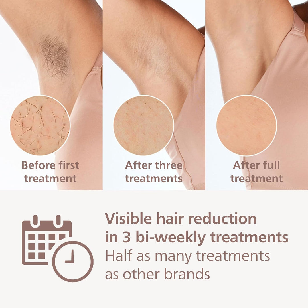 Philips Lumea IPL Prestige, 2 Attachments - Hair Removal Device (BRI944/00), BRI944/00