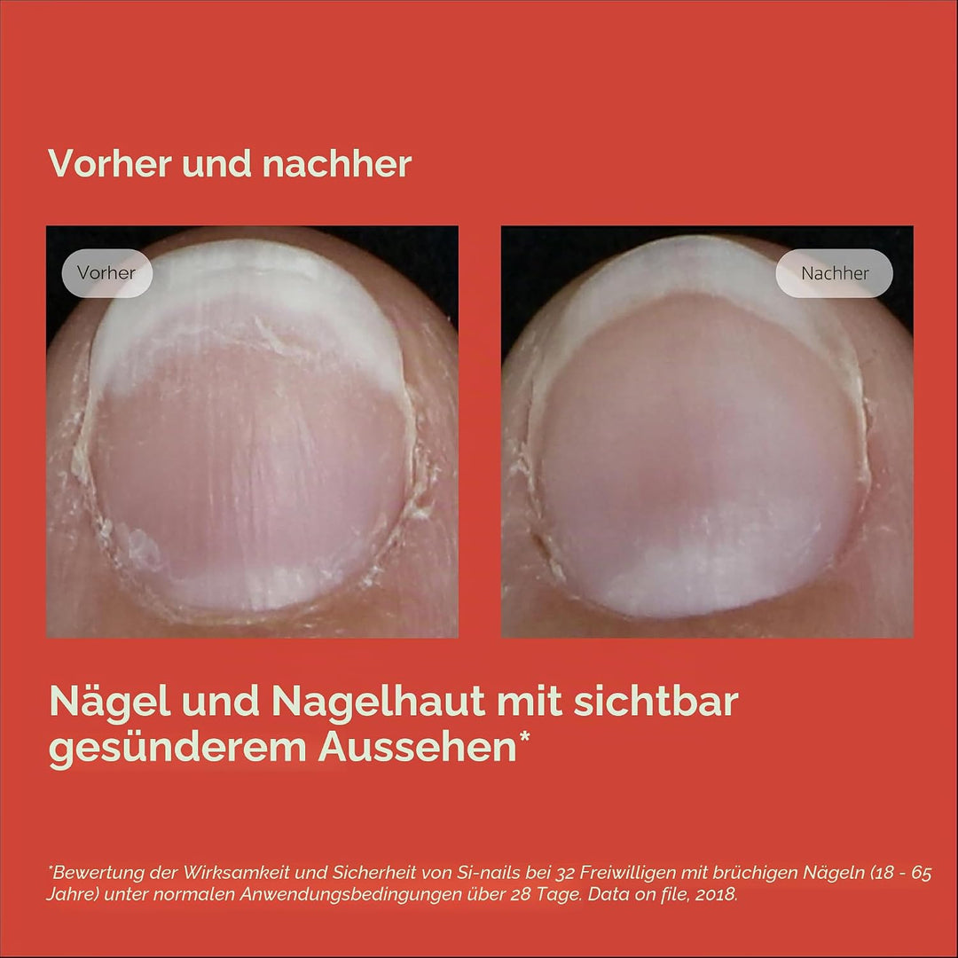 ISDIN SI-NAILS Nagelstärker für gesunde Nägel | Spendet Nägeln und Nagelhaut Feuchtigkeit | Härtet d