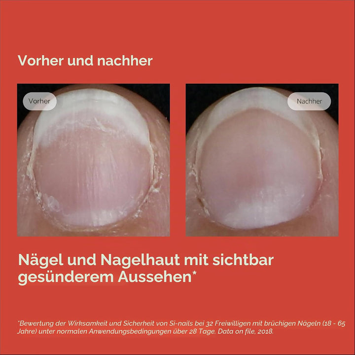 ISDIN SI-NAILS Nagelstärker für gesunde Nägel | Spendet Nägeln und Nagelhaut Feuchtigkeit | Härtet d