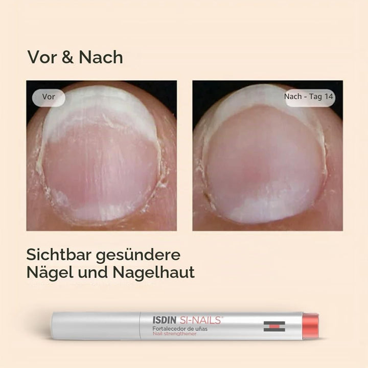 ISDIN SI-NAILS Nagelhärter für gesunde Nägel, spendet Feuchtigkeit für Nägel und Nagelhaut, härtet N