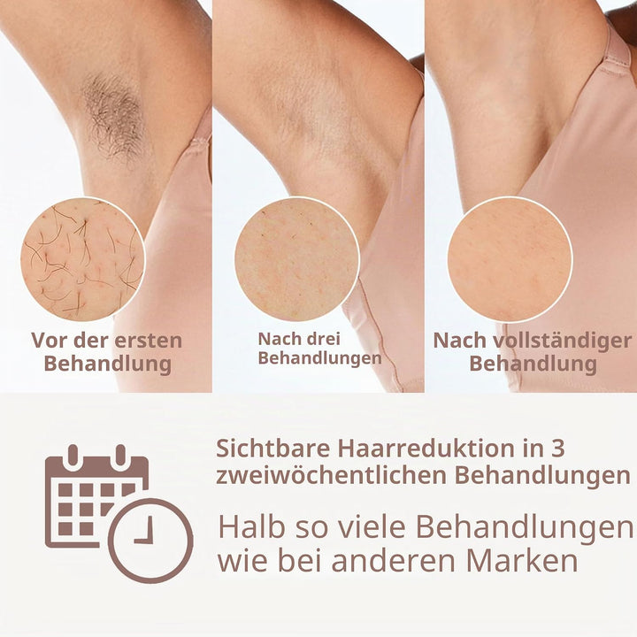 Philips Lumea IPL Prestige, 2 Attachments - Hair Removal Device (BRI944/00), BRI944/00