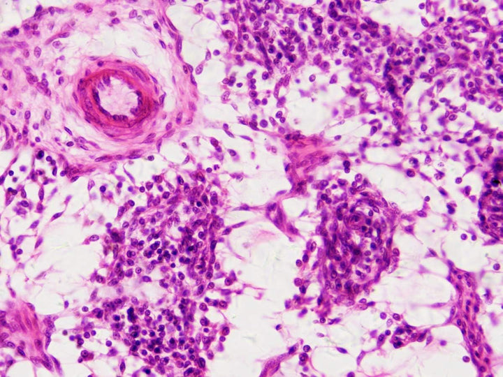 Bresser Mikroskop Dauerpräparate 30 Stück in Kunststoffbox, Lernpräparate aus der Biologie Single, S