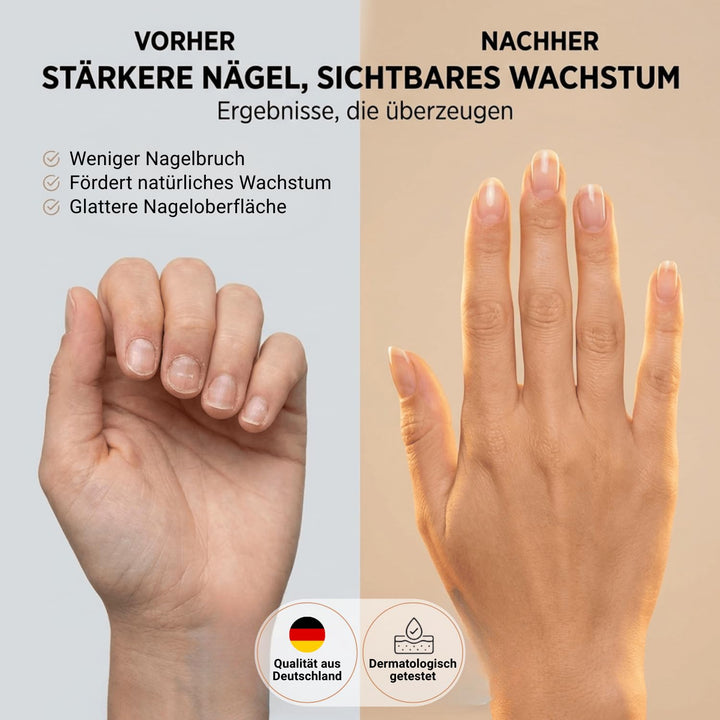 NCP new care Beauty Nail Wachstumslösung für Ebenmässige und Gestärkte Nägel – 10 ml – Tiefenwirksam