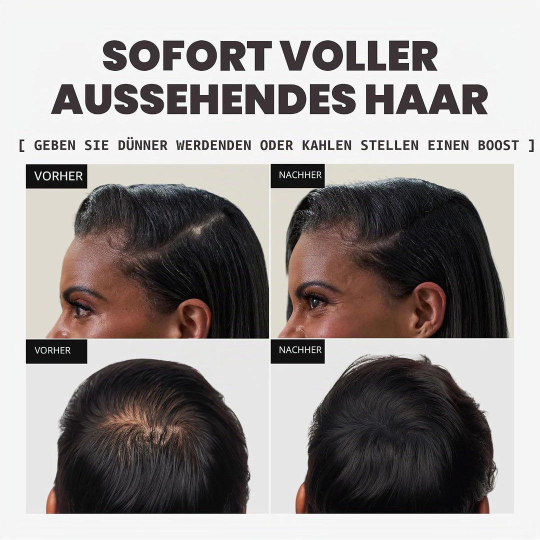 Toppik Haar fasern Medium Blonde 12 g (1er Pack), Medium Blonde 12 g (1er Pack)